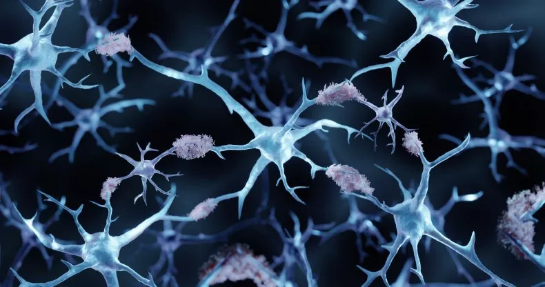 Scientists Discover Possible New Treatment for Alzheimer's