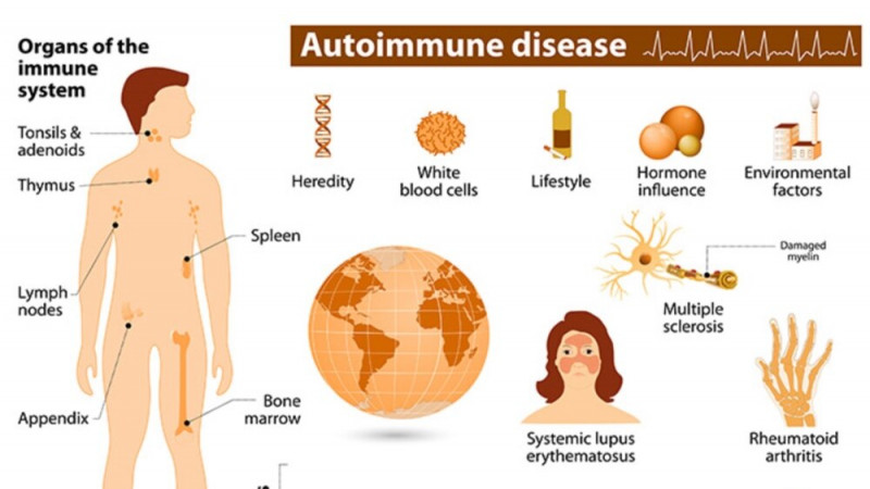 Autoimmune Diseases Affect More Women than Men