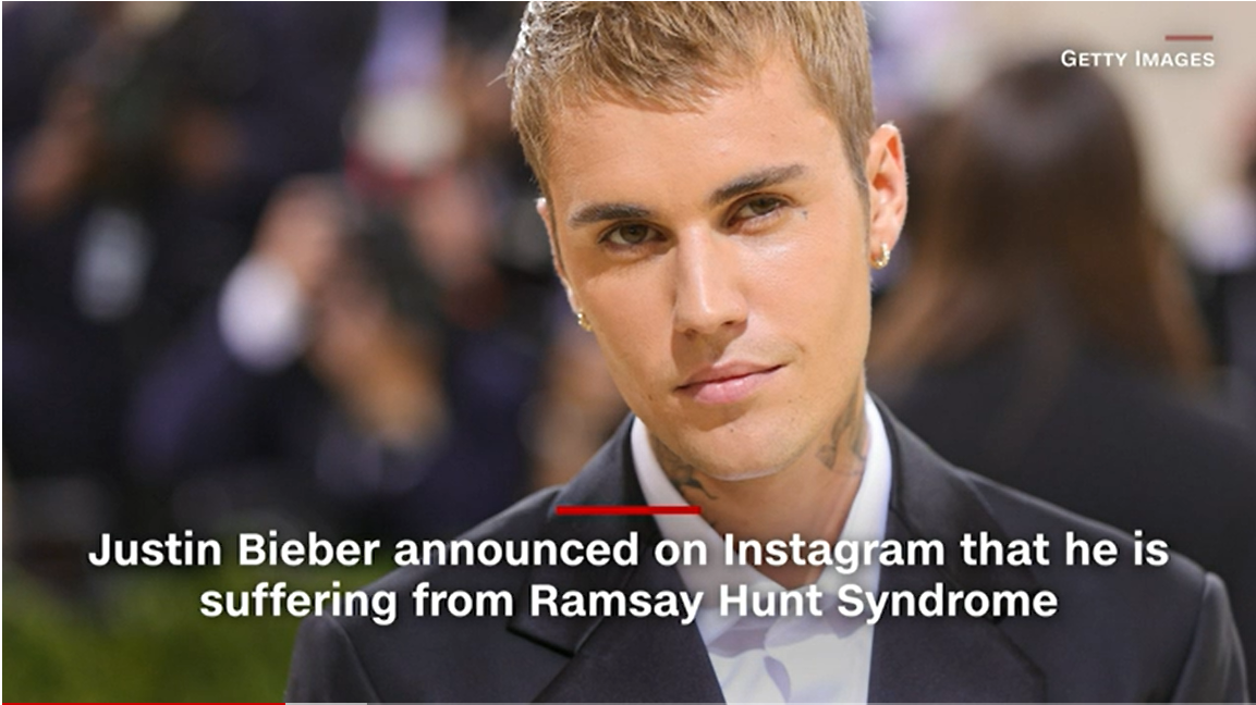 Justin Bieber says he has facial paralysis due to Ramsay Hunt syndrome