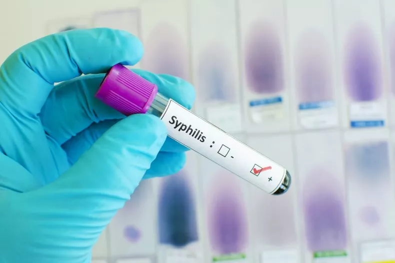 Syphilis Warning Issued to Americans
